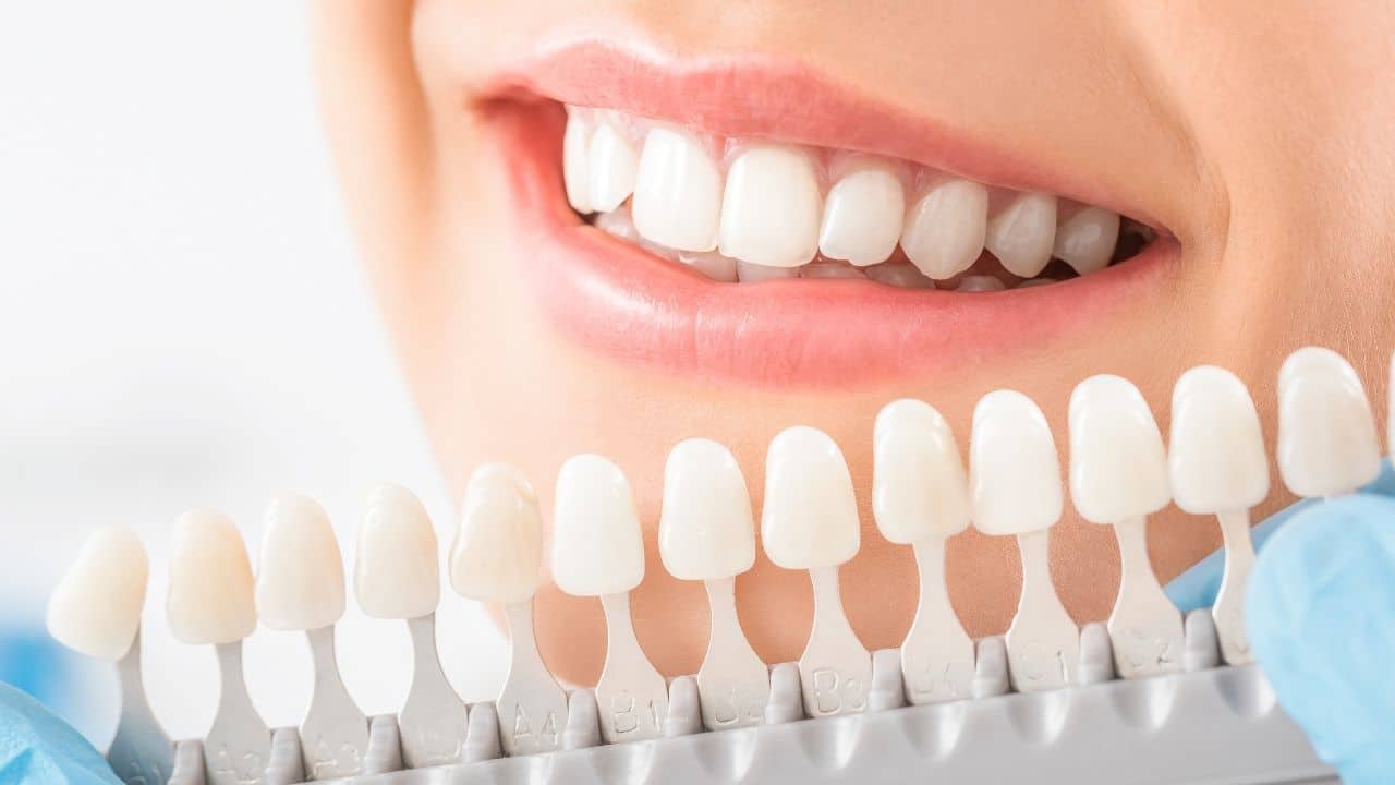 teeth whitening in Belper