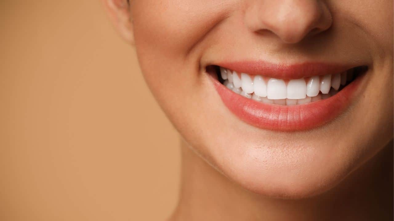 veneers in Belper
