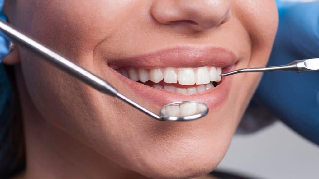 Composite bonding Belper