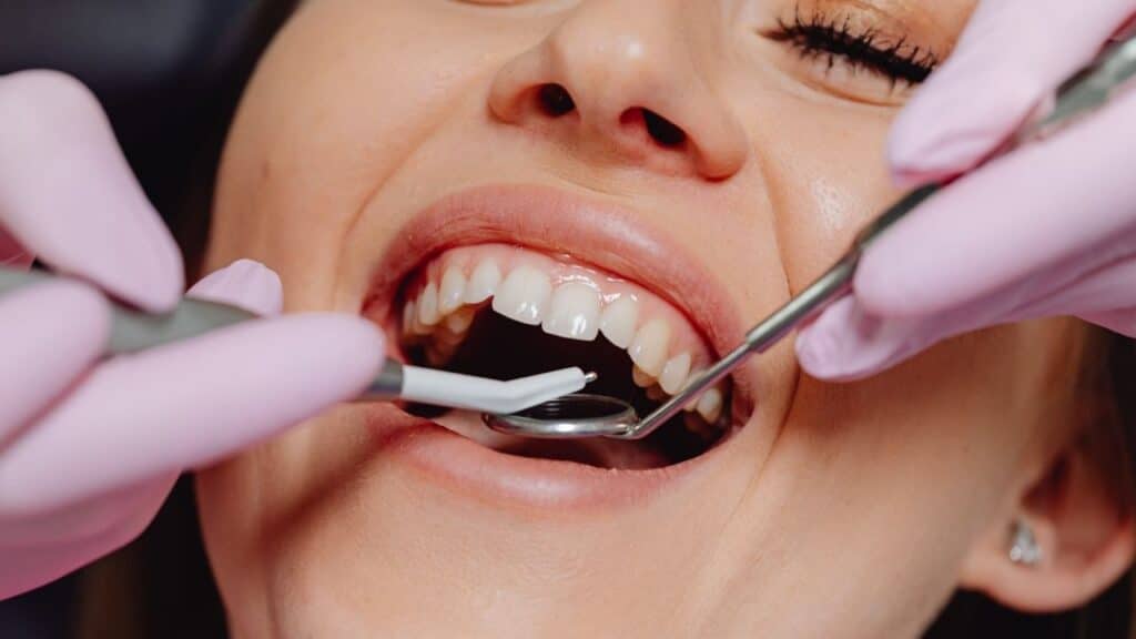 tooth extraction in Belper
