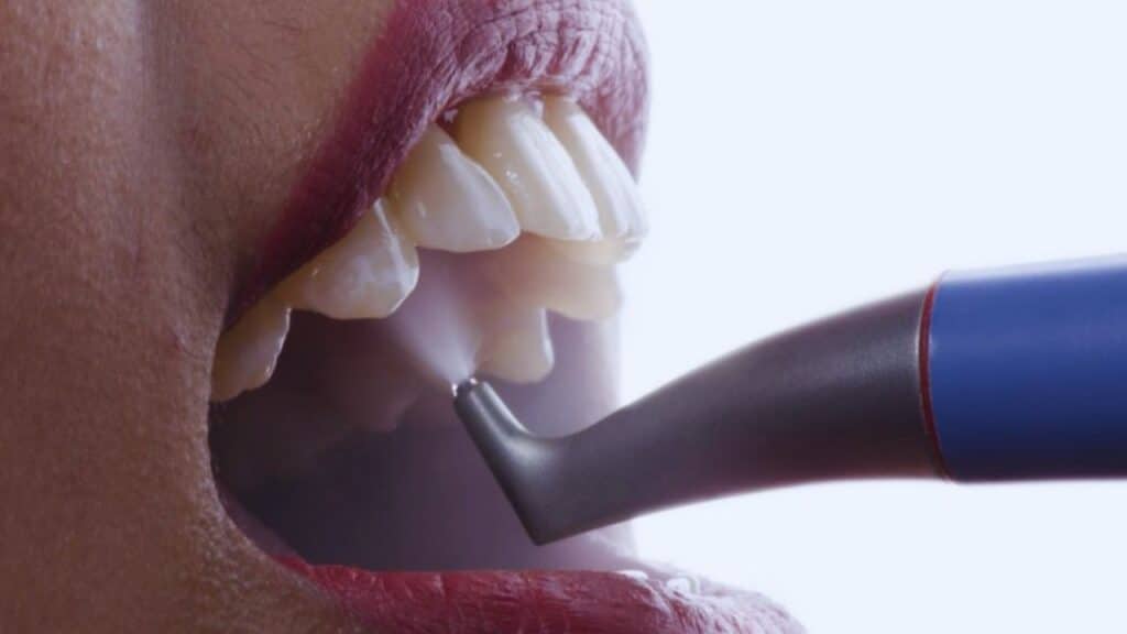 stain removal in Belper